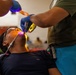 A dental procedure is being performed on a reclined patient wearing protective eyewear. A dental professional wearing blue gloves is using a UV curing light inside the patient's open mouth, likely curing a dental composite or sealant. The setting appears to be a community health clinic or field dental outreach event.