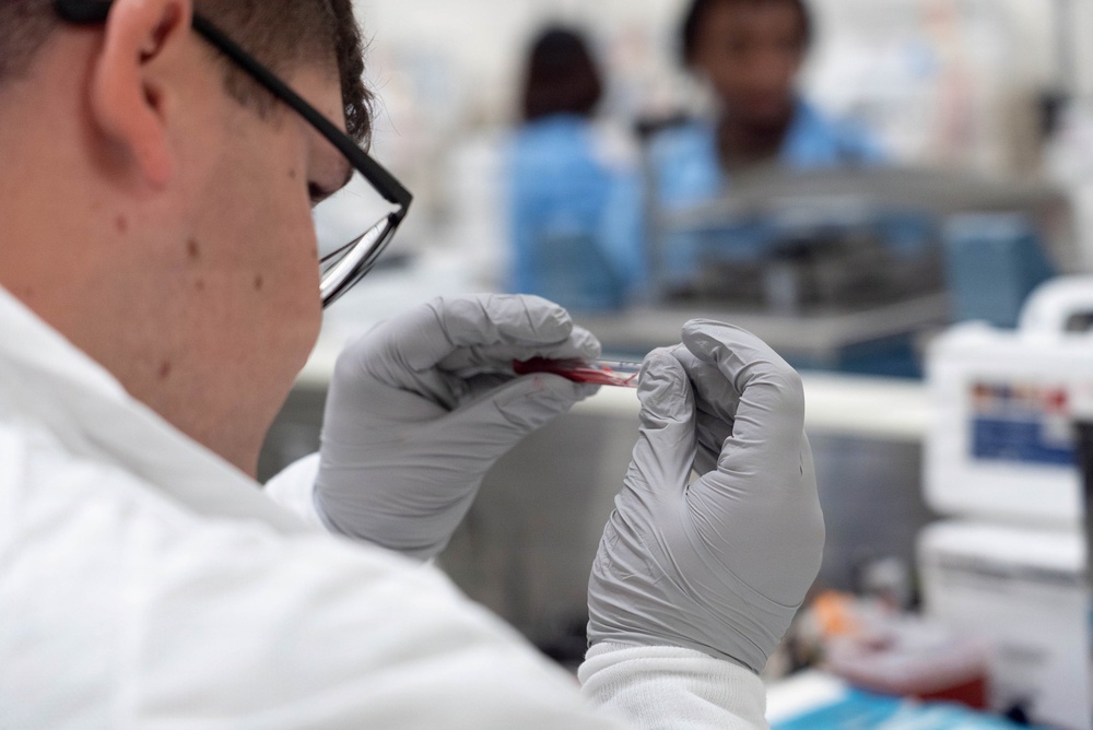 A laboratory technician wearing a white lab coat, black-framed glasses, and gray nitrile gloves is closely examining a small glass slide or specimen containing a red substance, likely blood. The setting appears to be a clinical or research laboratory environment. At least two additional personnel in blue scrubs or lab attire are visible in the blurred background.