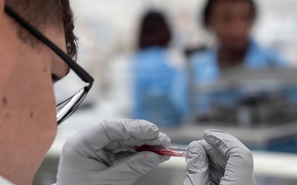 A laboratory technician wearing a white lab coat, black-framed glasses, and gray nitrile gloves is closely examining a small glass slide or specimen containing a red substance, likely blood. The setting appears to be a clinical or research laboratory environment. At least two additional personnel in blue scrubs or lab attire are visible in the blurred background.