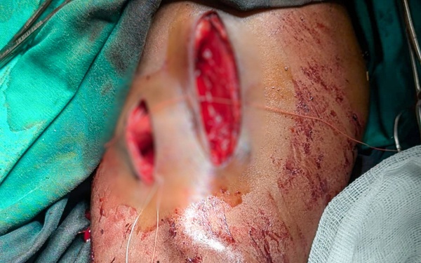 A wound carried for decades, US Army Reserve surgeon finds shared mission during medical readiness exercise