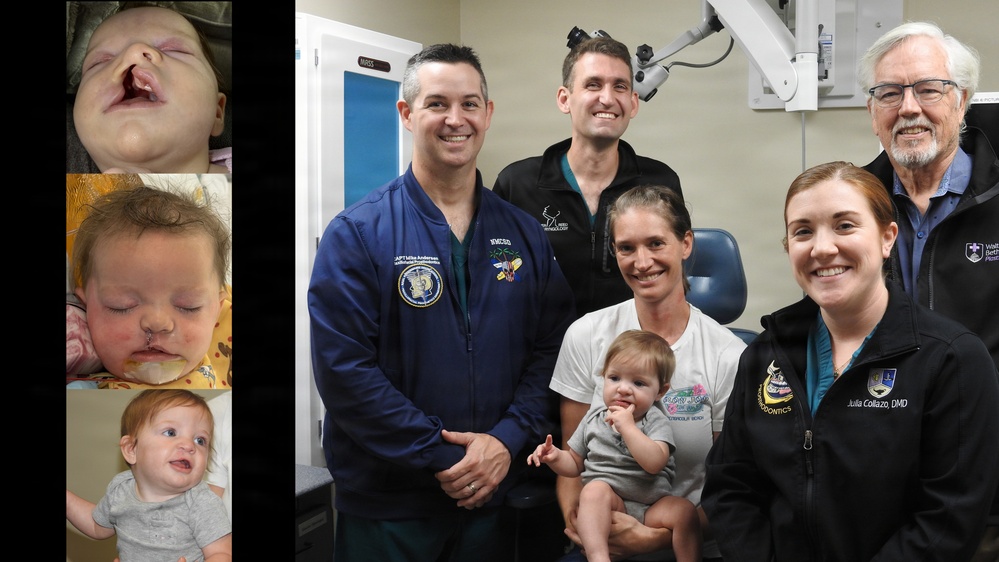 A New Chapter, a Brighter Smile: Violet's Journey Through Cleft Lip Recovery